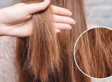 درمان موهای اسیب دیده