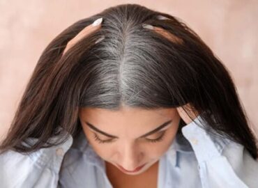 جلوگیری از سفیدشدن زودرس مو در جوانی