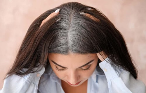 جلوگیری از سفیدشدن زودرس مو در جوانی